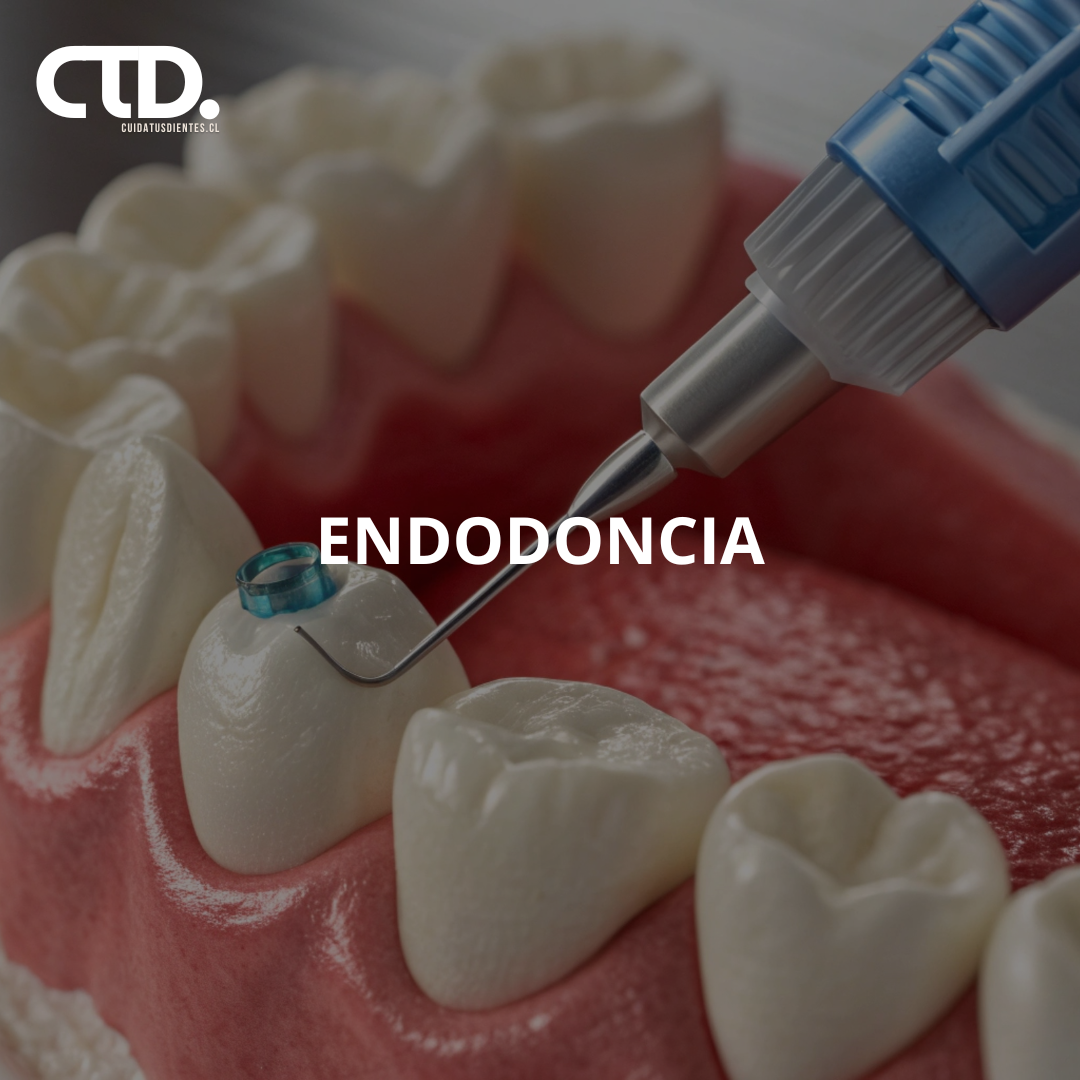 Pack endodoncia + restauración